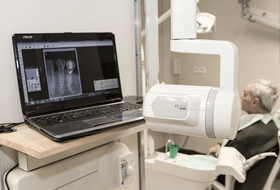 RTG zęba Warszawa Bemowo